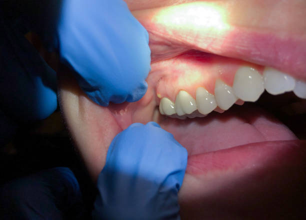 Best Pediatric Emergency Dentist in Fort Atkinson, WI